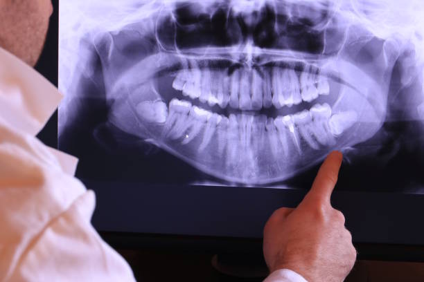Best Emergency Dentist for Lost Fillings or Crowns in Nashua, IA